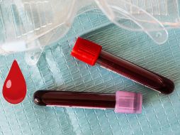 Los detalles se han publicado en la revista científica Blood.  ESPECIAL / PEXELS