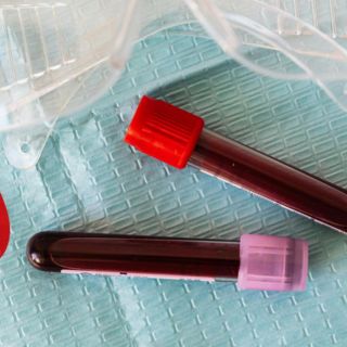 Científicos descubren un nuevo grupo sanguíneo tras años de estudio