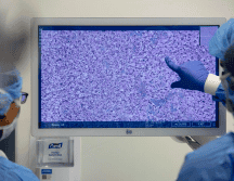 El éxito de CHIEF representa un cambio significativo en la forma en que se diagnostican y tratan los cánceres. NYU Langone Health