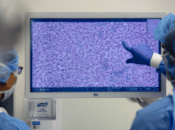 El éxito de CHIEF representa un cambio significativo en la forma en que se diagnostican y tratan los cánceres. NYU Langone Health