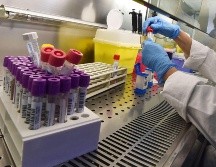 Los investigadores han subrayado la importancia de comprender los orígenes de la pandemia de COVID-19, sobre todo a la luz de otras propagaciones recientes, como la del virus de la gripe aviar en el ganado en Estados Unidos. EFE / ARCHIVO