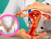 El uso de antibióticos es fundamental para tratar infecciones bacterianas, pero es importante ser consciente de sus efectos secundarios, como el riesgo de infecciones vaginales. CANVA