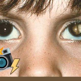 La enfermedad ocular que se detecta tomándote una fotografía con flash