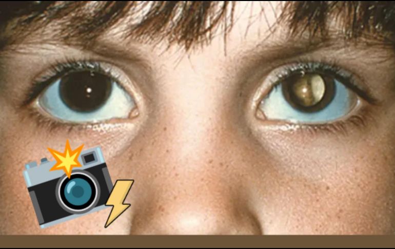 La utilización de fotografías con flash para detectar enfermedades oculares representa una herramienta innovadora y accesible para la identificación temprana de problemas visuales. ESPECIAL/American Academy of Ophthalmology