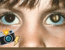 La utilización de fotografías con flash para detectar enfermedades oculares representa una herramienta innovadora y accesible para la identificación temprana de problemas visuales. ESPECIAL/American Academy of Ophthalmology