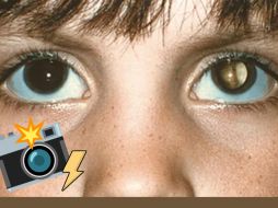 La utilización de fotografías con flash para detectar enfermedades oculares representa una herramienta innovadora y accesible para la identificación temprana de problemas visuales. ESPECIAL/American Academy of Ophthalmology