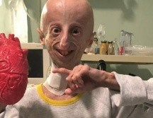 El científico italiano Sammy Basso falleció el pasado 6 de octubre a los 28 años de edad. Él padecía progeria y fue reconocido por dar visibilidad y estudiar su propia enfermedad. SUN / ESPECIAL / Sammy Basso