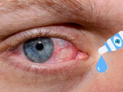 El síndrome del ojo seco es una condición que puede afectar la calidad de vida, pero su diagnóstico temprano y tratamiento adecuado pueden proporcionar alivio significativo. CANVA