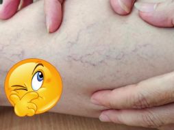 Es fundamental combinar su uso con un estilo de vida saludable y consultar a un profesional para un enfoque integral en el cuidado de la salud vascular. CANVA