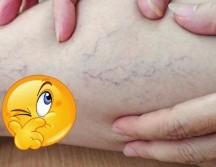 Es fundamental combinar su uso con un estilo de vida saludable y consultar a un profesional para un enfoque integral en el cuidado de la salud vascular. CANVA
