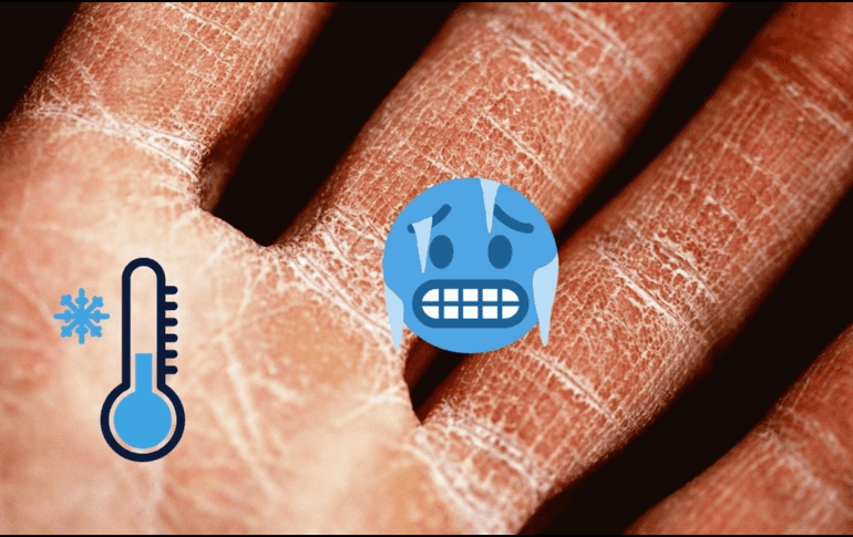 La temporada de frío ya está aquí y hay que cuidar nuestra piel. UNSPLASH / A. GREY