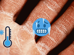 La temporada de frío ya está aquí y hay que cuidar nuestra piel. UNSPLASH / A. GREY