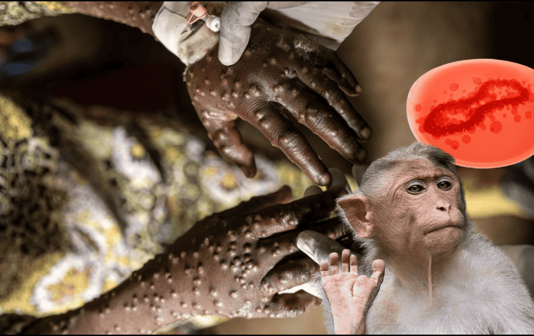 De acuerdo con la Unión Africana, al día de hoy se reportan mil 14 fallecimientos por mpox. EFE/ ARCHOVO/ ESPECIAL