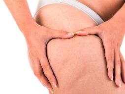 La celulitis es una condición común que puede verse afectada por varios hábitos de vida. El sedentarismo es uno de los principales factores que pueden empeorar su apariencia, pero adoptar hábitos saludables como el ejercicio regular, una dieta equilibrada y el cuidado adecuado de la piel puede marcar una gran diferencia.  CANVA