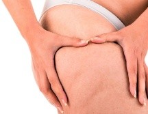 La celulitis es una condición común que puede verse afectada por varios hábitos de vida. El sedentarismo es uno de los principales factores que pueden empeorar su apariencia, pero adoptar hábitos saludables como el ejercicio regular, una dieta equilibrada y el cuidado adecuado de la piel puede marcar una gran diferencia.  CANVA
