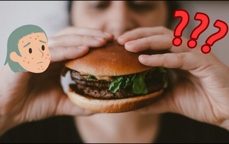 El acné se debe a múltiples factores. UNSPLASH / SS. VIKTOR