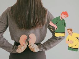 La formación de piedras en los riñones es una condición compleja que depende de múltiples factores, incluida la dieta.  CANVA