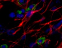 Las conclusiones del estudio se publicaron en la revista Stem Cell Research and Therapy. EFE /  CENTRO DE BIOLOGÍA MOLECULAR SEVERO OCHOA