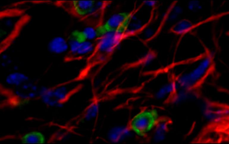 Las conclusiones del estudio se publicaron en la revista Stem Cell Research and Therapy. EFE /  CENTRO DE BIOLOGÍA MOLECULAR SEVERO OCHOA