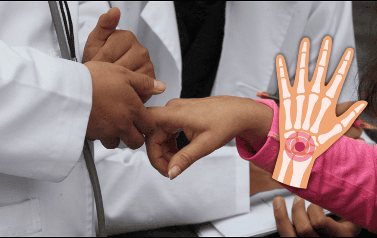 Estos suplementos ayudan a reducir la inflamación, mejoran la movilidad y contribuyen a prevenir la progresión de enfermedades crónicas como la artritis y la artrosis. NTX / ARCHIVO