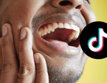 El mewing puede producir dolor en la mandíbula por la presión aplicada con la lengua. PEXELS / CANVA