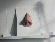 Si el problema persiste, no dudes en consultar con un especialista para recibir el tratamiento adecuado. UNSPLAHS /  T. JONSSON