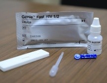 A nivel nacional en lo que va del año se han registrado nueve mil 502 casos de VIH. ESPECIAL