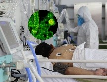 Esta infección si no se trata de manera oportuna y rápida puede incrementar significativamente el riesgo de mortalidad en un paciente grave. SUN / ARCHIVO / ESPECIAL / PEXELS CDC