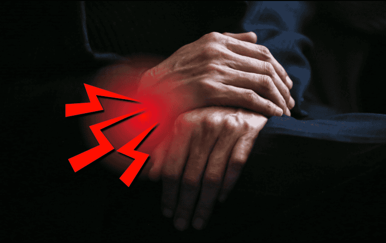 La artritis es la inflamación o degeneración de una o más articulaciones, que deriva en el daño de los cartílagos y en el roce y daño de los huesos. EFE / ARCHIVO