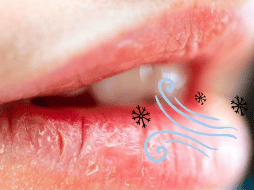 Además de los factores externos, a veces uno mismo provoca la resequedad en los labios. UNSPLASH / T. LITVYAK