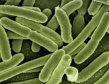 Se mantienen los procesos de evaluación para establecer si las muertes fueron ocasionadas por la bacteria Klebsiella oxytoca. ESPECIAL/ Imagen de Gerd Altmann en Pixabay