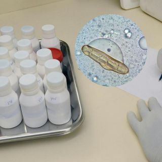 Localizan bacteria Klebsiella oxytoca en 4 hospitales del Edomex