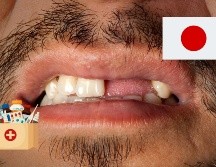 A diferencia de los reptiles o los peces, que reemplazan su dentadura regularmente, los humanos y otros mamíferos en general solo disponen de dos juegos de dientes. ESPECIAL / CANVA