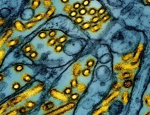 El virus mutó en el interior del primer paciente en condición grave en Estados Unidos, según las autoridades de salud del país. AP / ARCHIVO
