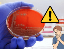 Además, la resistencia antimicrobiana afectará procedimientos médicos críticos, como trasplantes de órganos, tratamientos de quimioterapia y cirugías mayores, incrementando los riesgos para los pacientes. CANVA