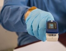 Las directrices no eliminarían los dispositivos antiguos que actualmente utilizan los médicos. NTX / ARCHIVO