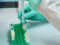 Las autoridades señalan que  esto no significa que haya alarma en México. SUN / ARCHIVO