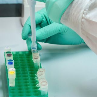 Reportan 150 casos de Metapneumovirus en Sinaloa