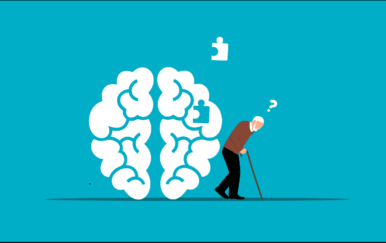 La conexión entre las encías y el cerebro resalta la importancia de mantener una buena salud bucal como un componente clave para reducir el riesgo de enfermedades neurodegenerativas. Pixabay