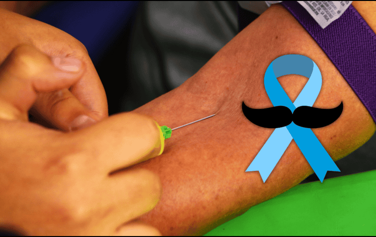 Se recomienda a todos los hombres que a partir de los 45 años de edad acudir anualmente a sus unidades médicas a realizarse un protocolo para detección de cáncer de próstata. EL INFORMADOR / ARCHIVO