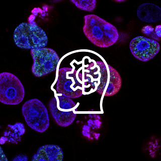 Científicos trabajan en IA que podría influir en la comprensión del cáncer