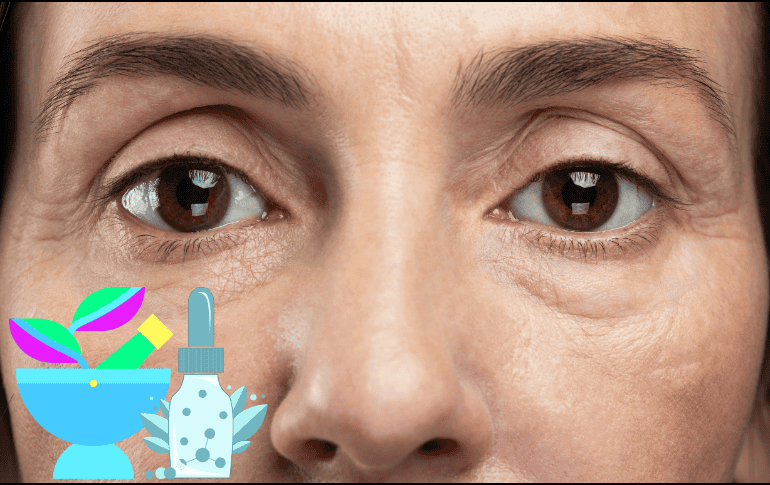 La aparición de ojeras pueden causar una apariencia cansada y poco estética en las personas en las que aparecen. CANVA/ ESPECIAL