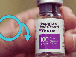 El bótox es una toxina que relaja los músculos y mejora la circulación sanguínea. Esta propiedad ha llevado a los científicos a explorar su aplicación en el tratamiento de la disfunción eréctil. AP / ARCHIVO