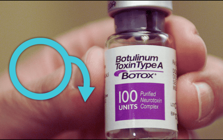 El bótox es una toxina que relaja los músculos y mejora la circulación sanguínea. Esta propiedad ha llevado a los científicos a explorar su aplicación en el tratamiento de la disfunción eréctil. AP / ARCHIVO