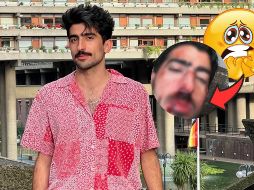 Muchos de sus seguidores consideran que la imagen podría tener múltiples interpretaciones, desde un efecto de maquillaje para alguna historia divertida hasta la posibilidad de una agresión real.  INSTAGRAM/jezzzini