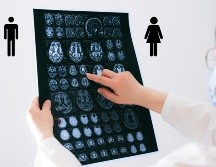 Las investigadoras sugieren que la expresión subclínica del riesgo genético de esquizofrenia podría diferir según el sexo. Pexels y Canva