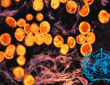 La variante menos letal de 2022 ya llevó a la OMS a una primera declaración de la emergencia sanitaria internacional. UNSPLASH / National Institute of Allergy and Infectious Diseases