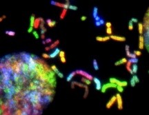 El síndrome de Down (SD) es una condición genética que ocurre cuando una persona tiene una copia extra del cromosoma 21. UNSPLASH / National Cancer Institute