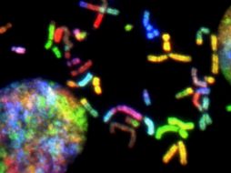 El síndrome de Down (SD) es una condición genética que ocurre cuando una persona tiene una copia extra del cromosoma 21. UNSPLASH / National Cancer Institute