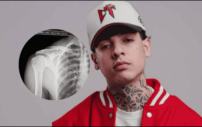 El cantante compartió en sus redes sociales que su cirugia salió bien. CORTESÍA